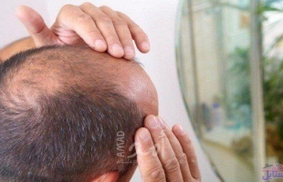 خدعها بـ"بروكة".. سيدة هندية ترفع دعوى قضائية ضد زوجها لإخفاء صلعته