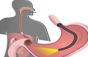 نوع من الخضار يدعم المناعة ويعزز كفاءة الهضم ويرطب الجسم
