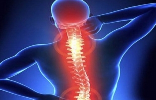 أشهر أعراض آلام العمود الفقري وطرق الوقاية العلاج