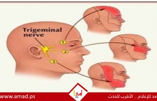 علامات الإصابة بالتهاب العصب ثلاثي التوائم