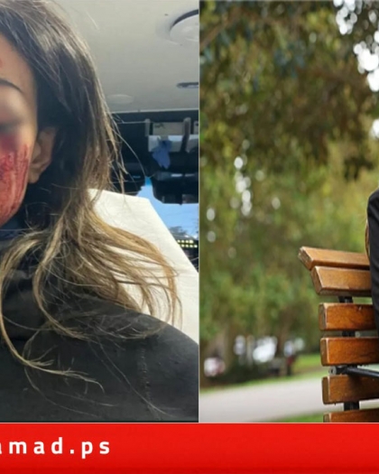 أستراليا.. هانا توماس مرشحة سابقة لـ"الخضر" قد تفقد بصرها من أجل فلسطين! صور