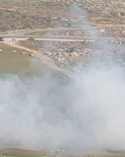 محدث -  6 إصابات إحداها حرجة برصاص مستوطنين في المغير شمال شرق رام الله